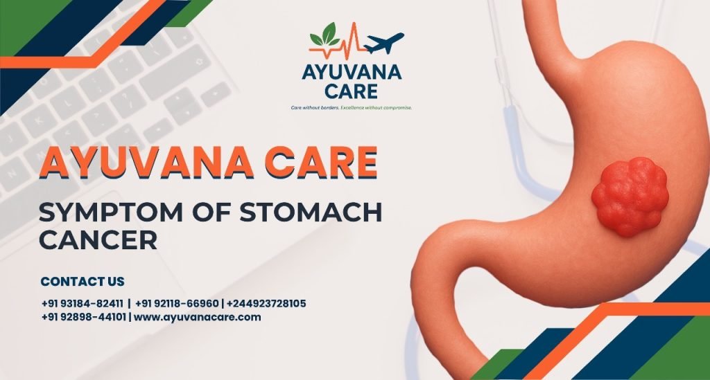 Top 7 Symptom of Stomach Cancer: Causes, Types, and Prevention Tips