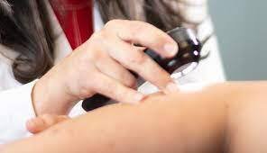 best skin cancer treatment